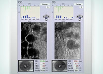Microscopia Especular - Institudo de Olhos Limongi